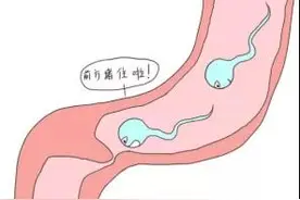 “男扎”与“复通”，在三胎政策下，掌控生育的自由图片