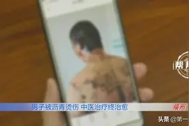 滚烫的沥青从头浇下，男子全身多处遭遇严重烧烫伤图片