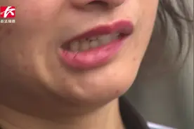 妙龄女子整容整成歪嘴，却遭整形医院回怼：职业医闹视频封面