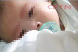 怀胎6个月，宝宝患罕见病，妈妈做了个大胆的决定图片