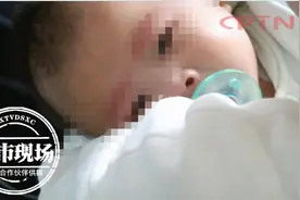 怀胎6个月，宝宝患罕见病，妈妈做了个大胆的决定图片
