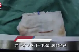 男子吃饭误吞鱼刺，扎穿消化道刺入肝脏险要命视频封面