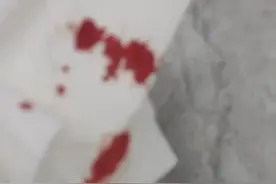 头上磕的鲜血直流，却只贴了个创可贴图片