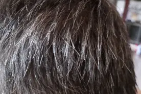 黑豆加醋熬成膏能染发？伤害性极大图片