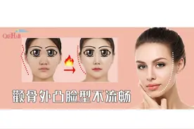 ​改善太阳穴凹陷、颧骨突出，打造流畅面部线条图片