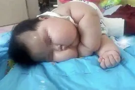 8个月宝宝长到30斤，宝妈拍照发到网上炫耀，医生：别高兴太早图片