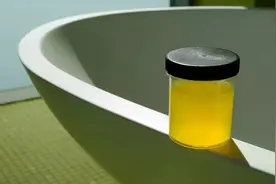 上厕所时，若发现尿液发黄还有异味，是怎么回事？不妨参考下图片