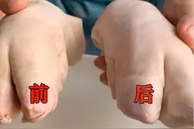 买猪蹄“前蹄”和“后蹄”有什么区别？看完明白了，记得提醒家人图片