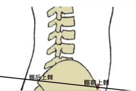 骨盆前倾的自救  告别假翘臀，迎来健康美图片