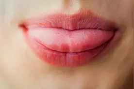 舌头边上有牙齿印？很有可能是脾虚和水湿留滞图片