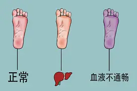 老没老，看看脚就知道！分享几个脚部养生方法，养好双脚寿命长图片