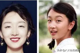 双眼皮力量到底有多大？埋线修复的话，只要把线取出来就行吗？图片