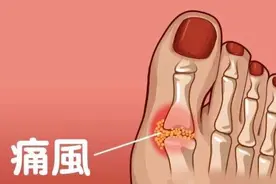 多喝牛奶对痛风有什么好处？听听药师怎么说图片