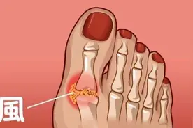 多喝牛奶对痛风有什么好处？听听药师怎么说图片