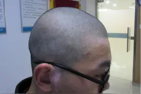 营养不良导致身体亮红灯，青少年发育阶段家长要引起重视图片