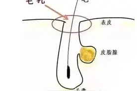 【你分的清吗？】什么是皮脂腺囊肿？什么是脂肪瘤？图片