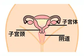 听说女人老了之后，子宫都会从下面“掉”出来？图片