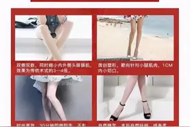 小腿神经阻断术”网络流行，神经科医生：不可逆，会出现肌肉萎缩图片