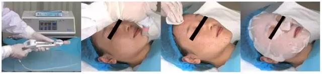 关于美容针，这篇文章都给你说清楚了