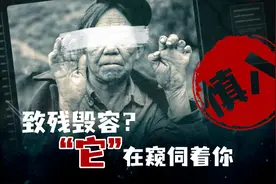 【慎入】比死神还可怕、比魔鬼还狰狞的古老瘟疫图片