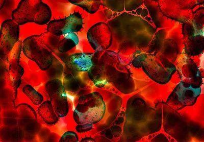 蛋白质如何提高免疫力？如何补充足够蛋白质？