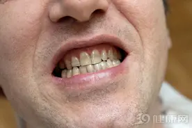 可怕…哈佛发表20年研究结果：牙不好的人，患癌风险增加52%图片