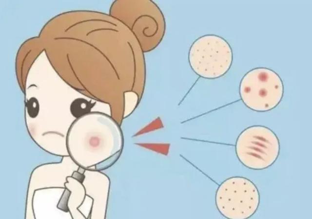 广州市鱼鳞病哪家医院最好的医院