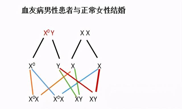 血友病的遗传方式?（准父母一定要注意）