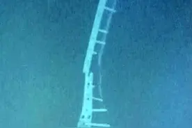 手术后钢板断裂谁之过？图片