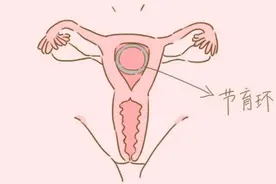 为什么女生上环后，可以起到避孕效果？看完你就懂了图片