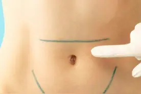 同是剖腹产，横切和竖切有何差别？“这一刀”别乱选，两者大不同图片