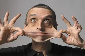 英国男子患有罕见皮肤病，皮肤可随意拉伸16CM，路人都不敢直视图片