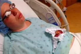 那位出生仅25厘米重280克的“拇指姑娘”，18岁过去，已变成女神图片