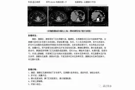 小小皮肤红肿，也可能是致命的疾病！这一类皮下感染不要疏忽图片