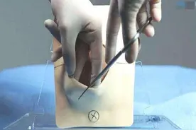 生娃时劲儿使大了，“收不住”造成侧切咋办？过来人的经验很实用图片