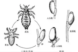 男子屁股痒，医生用镊子夹出15只阴虱！原来有3个传播途径图片