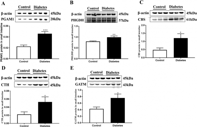 小肠蛋白质组学联合血清代谢组学揭示T2DM中华仓鼠氨基酸代谢紊乱