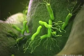幽门螺杆菌“病因”找到了，医生奉劝：2类食物再馋也别往嘴里塞图片
