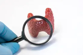 3种食物堪称甲状腺结节“催化剂”，医生说：只要管住嘴你就赢了图片