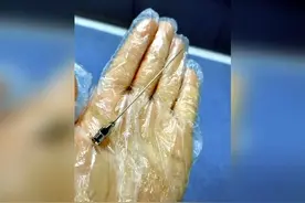 剖宫产真的那么简单吗？看看这场手术用到的工具，你就知道了图片