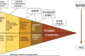 妙手愈沉疴｜原发性胆汁性胆管炎能治愈吗?图片