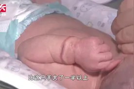 出生9天婴儿现勒痕，局部皮肤发紫坏死，只因家长这一个动作视频封面