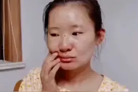 哭笑不得！山西一女子怀孕38周突然面瘫，一旁老公不厚道地笑了图片
