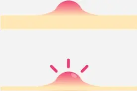 「生理与健康」一文让你明白，自己到底是哪里上火了，速读自查图片