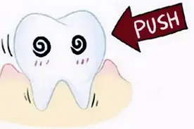 牙齿松动的8种治疗方法#雅悦齿科#图片