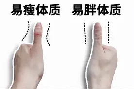 看一眼大拇指就知道你是易胖瘦还是易胖体质，这个方法不试试吗？图片