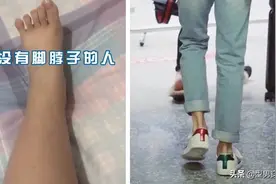 没有“脚脖子”多显腿粗？张萌虞书欣也这样，粗脚踝穿鞋避雷指南图片