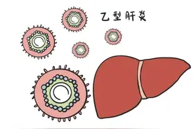 慢性乙肝自然恢复的三种可能图片