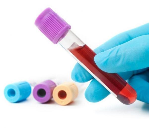 谷氨酰转肽酶高是怎么回事？不一定是肝炎，饮酒和药物损害可引起