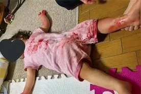 妈妈出门缴电费，回家开门瞬间令她崩溃：3岁女儿躺在“血泊”中图片